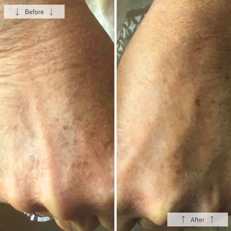 Contour Glove