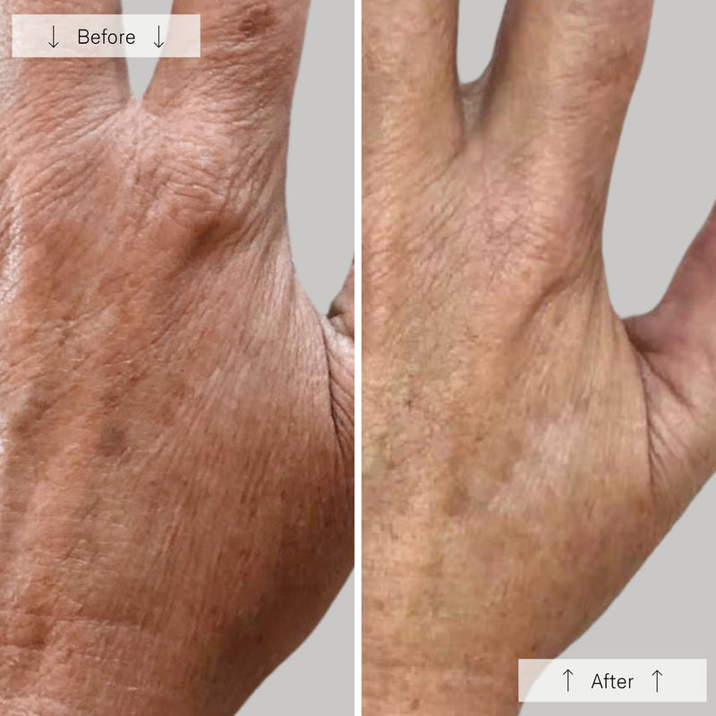 Contour Glove