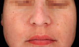 Cosmelan Professional Treatment (Mandatory In Spa Appointments Required)once purchased please call us to schedule your appointment in LA or Miami