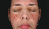 Cosmelan Professional Treatment (Mandatory In Spa Appointments Required)once purchased please call us to schedule your appointment in LA or Miami