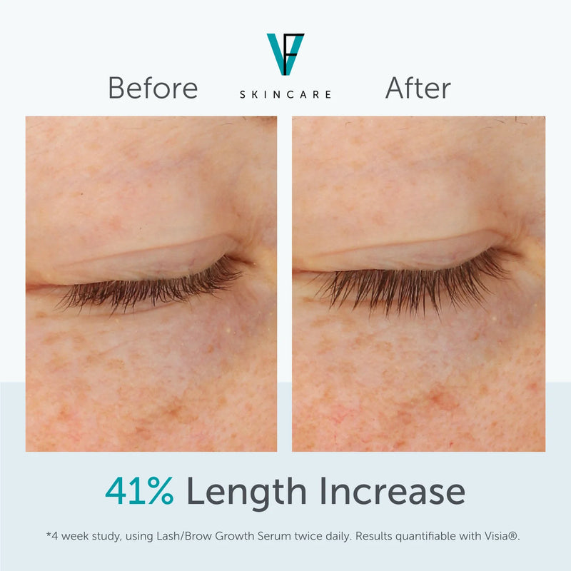 FactorFive Eye/Lash Growth Serum