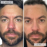 Omnilux Men LED Face Mask